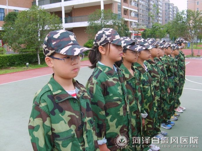 青少年白癜风军训